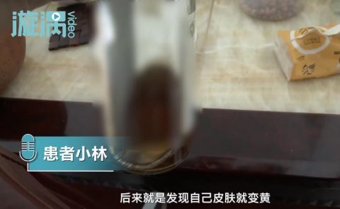 警惕饮酒过量，酒后黄色呕吐物的警示